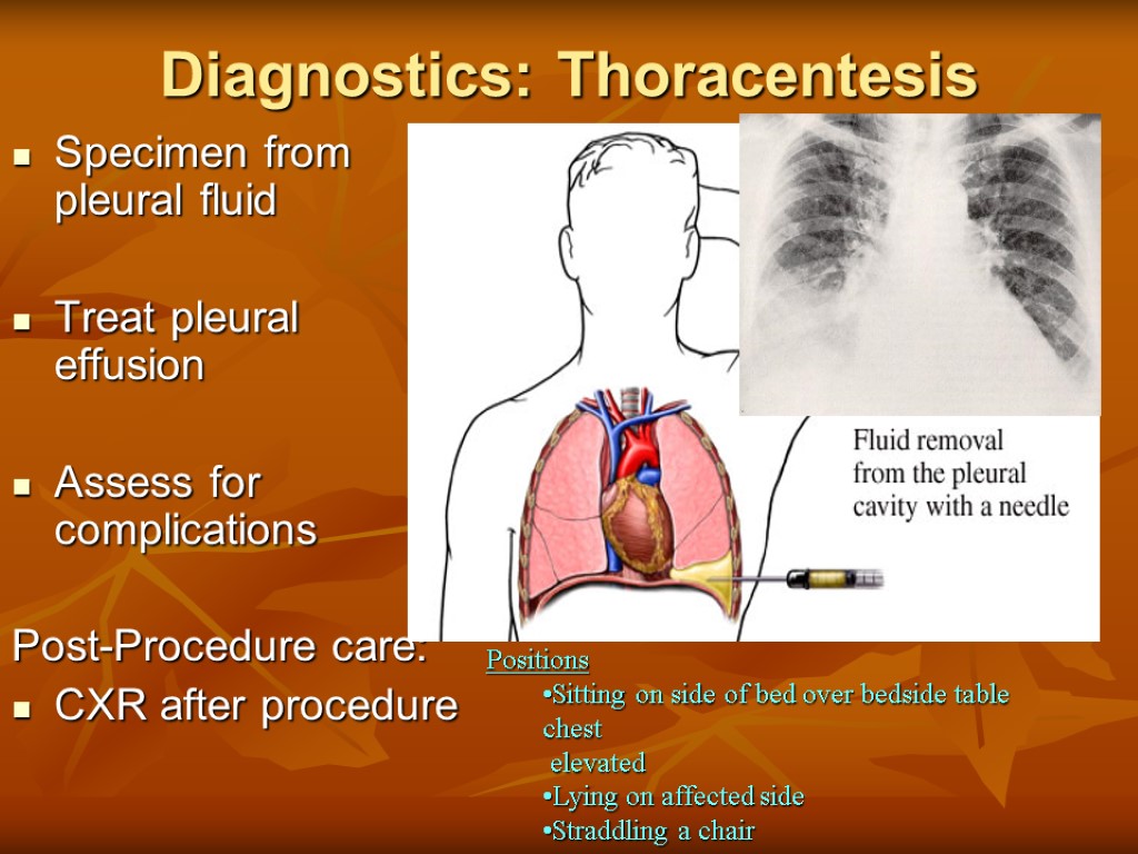 Diagnostics: Thoracentesis Specimen from pleural fluid Treat pleural effusion Assess for complications Post-Procedure care: